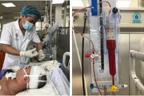 Kỳ tích cứu sống bệnh nhân 18 tuổi đột quỵ não nặng, hôn mê sâu