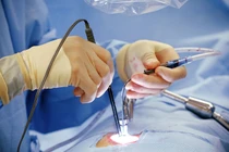 Hút mỡ bụng, cô gái 33 tuổi tử vong ngay trên bàn mổ