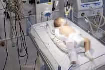 Bé 2 tháng tuổi bị bạo hành ở Lâm Đồng: Còn bao vụ rúng động dư luận?