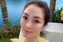 Hoa hậu Nguyễn Thị Huyền gây sửng sốt với khuôn mặt vline