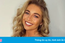  Nàng WAGs quyến rũ giúp Scott McTominay tìm lại phong độ