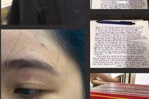 Hà Nội: Nhân viên bánh mì Nguyên Sinh bị tố hành hung khách