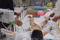 Bệnh nhi tử vong sau tháo đinh nẹp: Giám đốc SYT Bình Phước lên tiếng