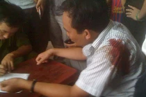 Đình chỉ CSGT nổ súng bắn 2 người bị thương