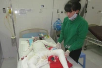 Cháu bé bị đốt cháy toàn thân đã tử vong