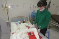 Cháu bé bị đốt cháy toàn thân đã tử vong