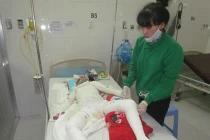 Cả nhà bị kẻ lạ mặt đốt khi đang ngủ