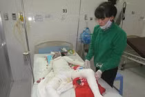 Cả nhà bị kẻ lạ mặt đốt khi đang ngủ