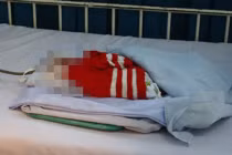 Suýt chôn sống con vì... bác sĩ