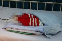 Suýt chôn sống con vì... bác sĩ