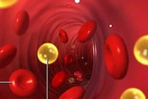 Những căn bệnh liên quan, dễ gây biến chứng mỡ máu cao