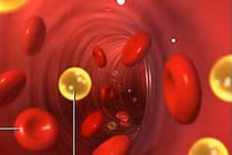 Những căn bệnh liên quan, dễ gây biến chứng mỡ máu cao