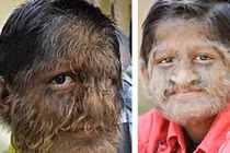 Rùng rợn những chứng bệnh nghe tên đã sợ