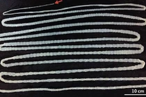 Nuôi sán dài 6m nhiều năm trong bụng vì ăn thịt bò tái