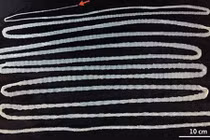 Nuôi sán dài 6m nhiều năm trong bụng vì ăn thịt bò tái