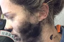 Hãi hùng tai nghe phát nổ trên mặt hành khách đi máy bay