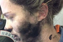 Hãi hùng tai nghe phát nổ trên mặt hành khách đi máy bay