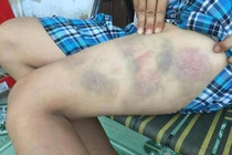 Cha đánh con giữa đường, công an phải giải cứu