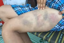 Cha đánh con giữa đường, công an phải giải cứu