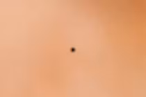 6 nốt ruồi mang lại phúc lộc cả đời cho chủ nhân