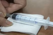 Sốc với chiếc kim khâu dài 4 cm trong cổ họng bé gái 1 tuổi