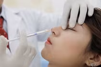 Bị thối thịt sau 2 ngày cấy chỉ nâng mũi