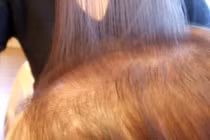 Điểm mặt 5 nguyên nhân gây rụng tóc ở phụ nữ