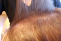 Điểm mặt 5 nguyên nhân gây rụng tóc ở phụ nữ