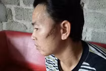 Chém hàng xóm vỡ xương hàm vì giằng micro hát trong đám cưới