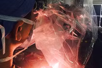 Trải lòng của một bác sĩ về vấn nạn “phong bì” gây sốt mạng