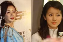 Thảm họa phẫu thuật thẩm mỹ của 9 sao Hoa – Hàn