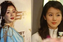 Thảm họa phẫu thuật thẩm mỹ của 9 sao Hoa – Hàn