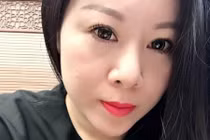 Đắng ngắt hậu quả phẫu thuật thẩm mỹ thất bại