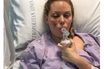 Hoa hậu Australia bỏng nặng vì trúng lựu đạn ở mặt