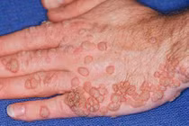 Mua hàng thanh lý trên mạng, cảnh báo căn bệnh nguy hiểm