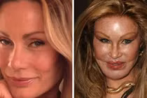 Kinh hoàng gương mặt ma quỷ của “thảm họa dao kéo“