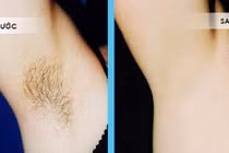 Mẹo hay giúp bạn không cần nhổ lông nách trong mùa đông