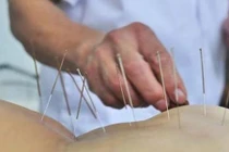 Sập bẫy dịch vụ châm cứu, bấm huyệt chui tại nhà