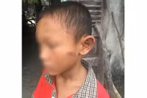 Phẫn nộ dì ruột bạo hành bé trai dã man 