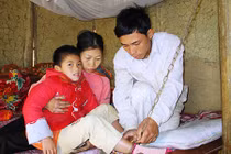 Đau lòng số phận cô bé “ma cà rồng” ở Thanh Hóa