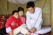 Đau lòng số phận cô bé “ma cà rồng” ở Thanh Hóa