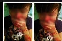 Phản cảm gái trẻ tự “giết mình” bằng những trò câu like rùng mình