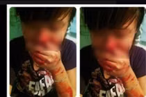 Phản cảm gái trẻ tự “giết mình” bằng những trò câu like rùng mình