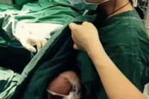 Ấn tượng nữ y tá cho bệnh nhi bú trước phẫu thuật