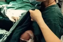 Ấn tượng nữ y tá cho bệnh nhi bú trước phẫu thuật