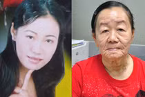 Bi kịch những cô gái trẻ mặc bệnh biến thành bà lão