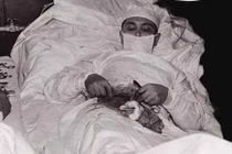 Kinh ngạc những ca phẫu thuật khó tin nhất lịch sử loài người