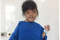 Nghị lực phi thường của cô bé không có ngón tay 