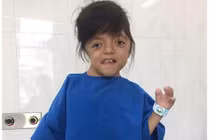 Nghị lực phi thường của cô bé không có ngón tay 