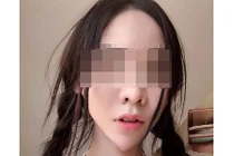 Hoảng loạn tháo chạy khi thấy khuôn mặt hotgirl mặt rắn